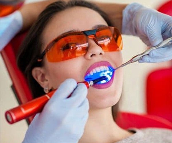 Professional Teeth Whitening Services in Dubai – Brighten Your Smile at Somerset Clinic. Family dental care clinic Dubai – Teeth whitening services for a brighter smile in Dubai at Somerset Clinic.Teeth whitening services for a brighter smile in Dubai at Somerset Clinic.